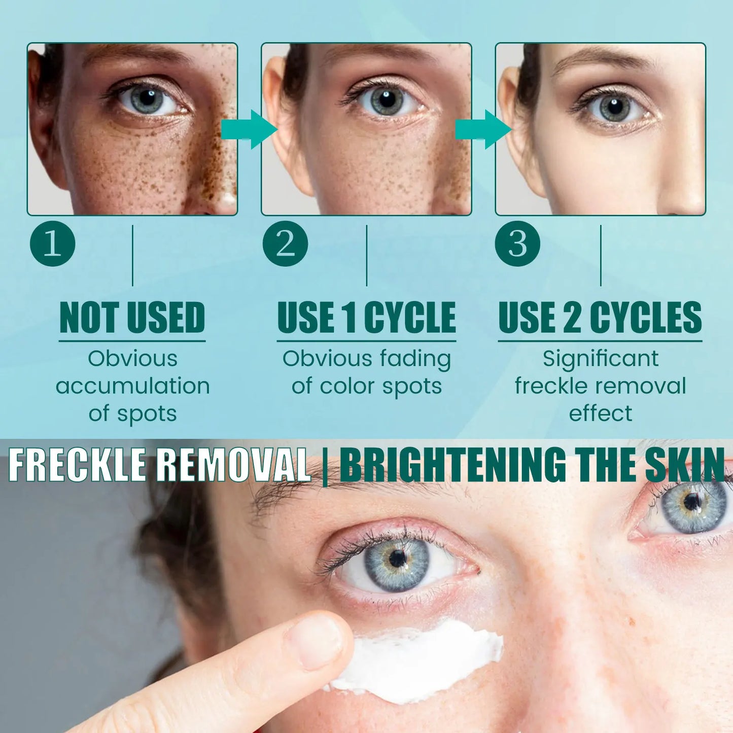 South Moon 20g Anti Pigmentation Face Cream Whitening Dark Spot Lighten Refining Skin Hydrate Repair Rough Dullness Facial Cream