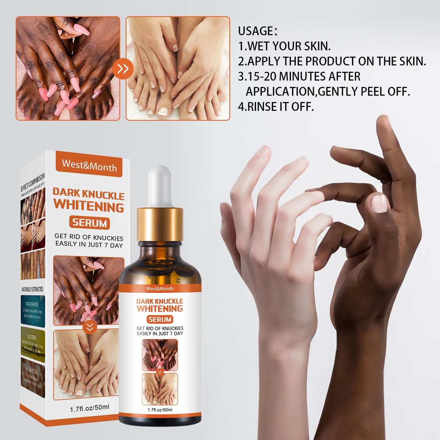 West Month Body Dark Knuckle Whitening Serum Moisturizing Body Brightening Dark Remover Smoothing Hand Butt Knee Bleaching Serum