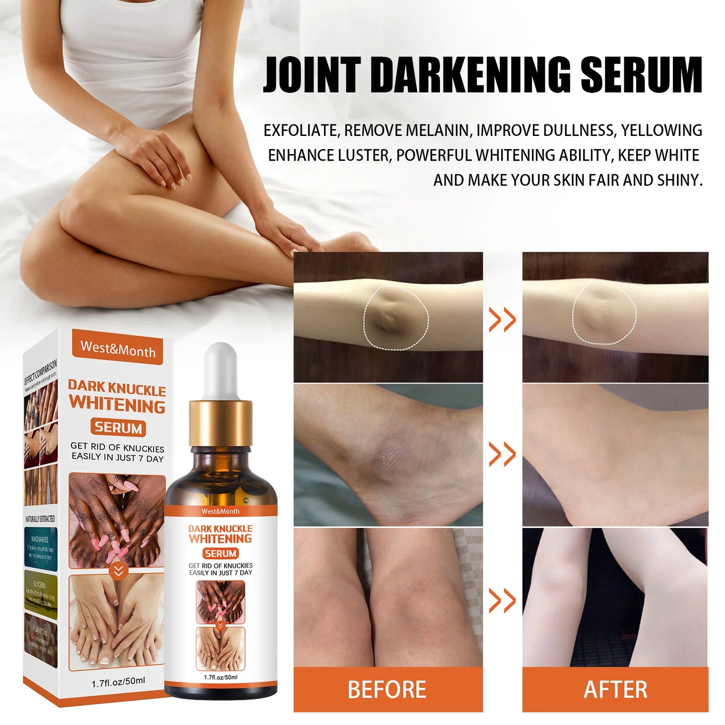 West Month Body Dark Knuckle Whitening Serum Moisturizing Body Brightening Dark Remover Smoothing Hand Butt Knee Bleaching Serum