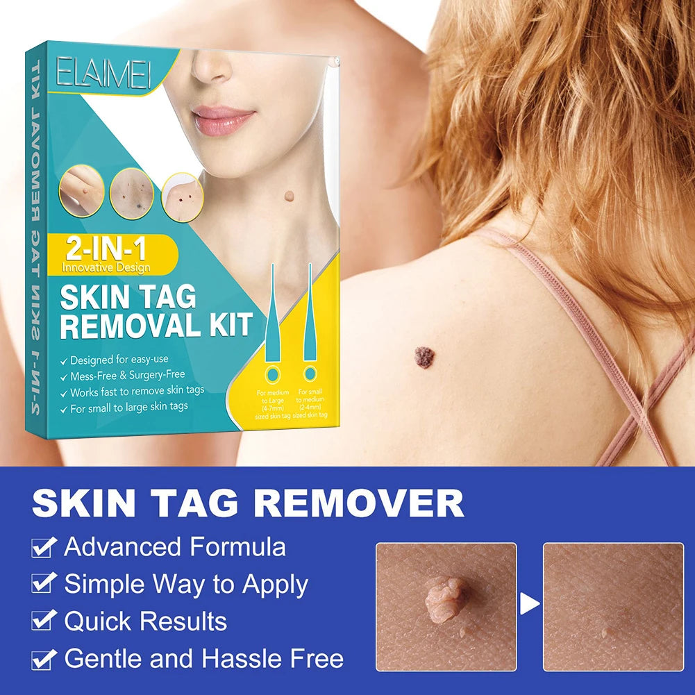 2-IN-1 Auto Skin Tag Removal Tool Kit Painless Skin Label Mole Acne Wart Removal Pen with Cleansing Swabs Facial Skin Care Tool