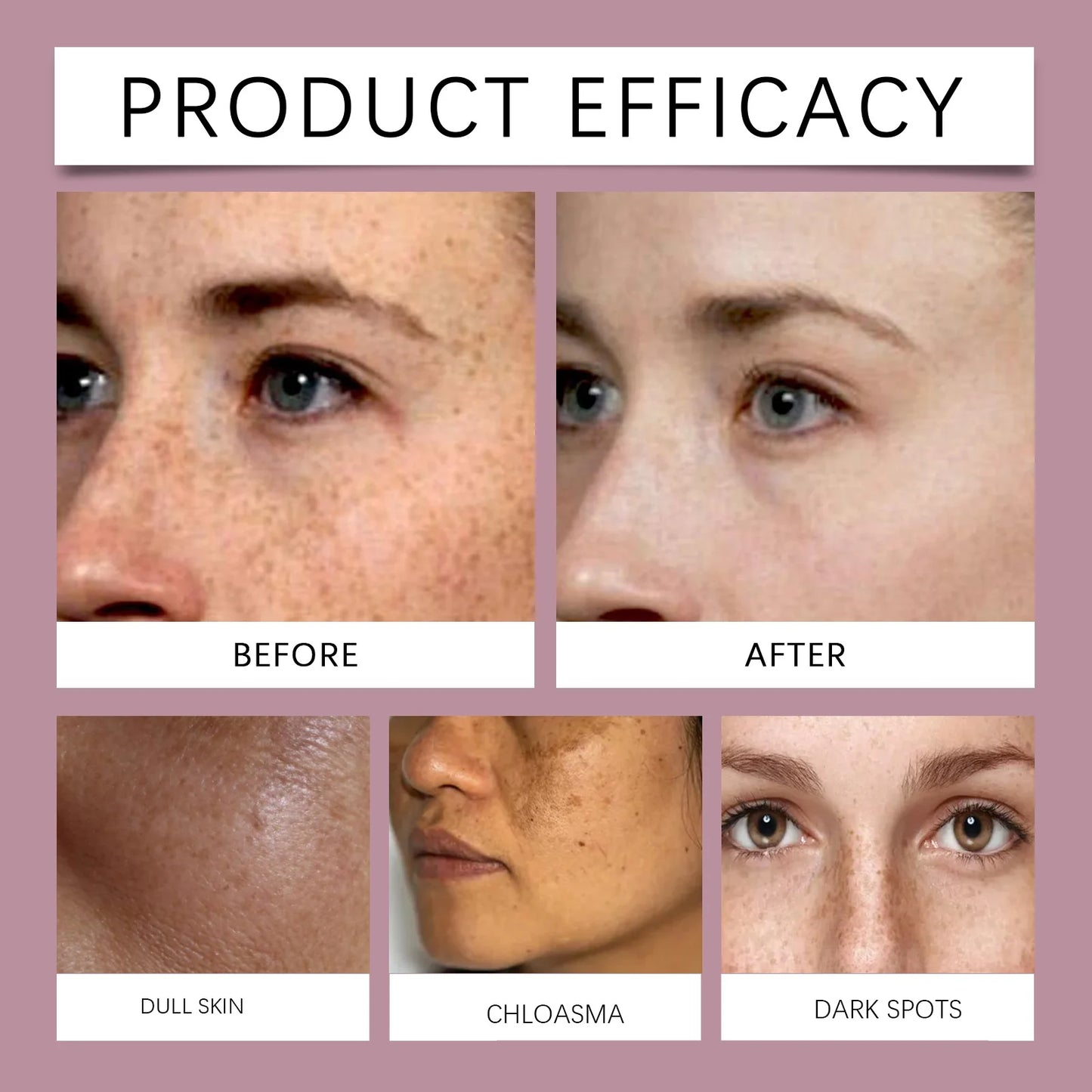 Spot Lightening Face Cream Niacinamide Whitening Cream Dimming Pigmentation Brightening Moisturize&Firm Skin Facial Care Product